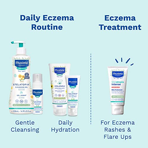 Mustela Eczema Relief Cream Stelatopia Intense - Fragrance-Free Moisturizing Body Lotion with Colloidal Oatmeal - For dry, itchy, irritated skin & flare-ups - 5.07 fl. oz.