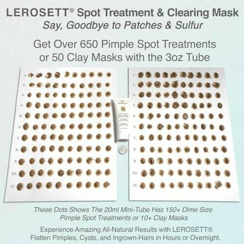 LEROSETT Spot Treatment & Clay Mask - Swedish Facial Clay for Acne, Oily & Congested Skin, Blemishes, Blackheads, Pimples, Ingrown Hairs, Tighten Pores. Fast-Drying. Natural. Vegan. 650+ Uses 3oz - The European Gift Store